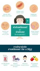 การรักษาผิวติดสารสเตียรอยด์ โดย อ.วิสิฏฐ